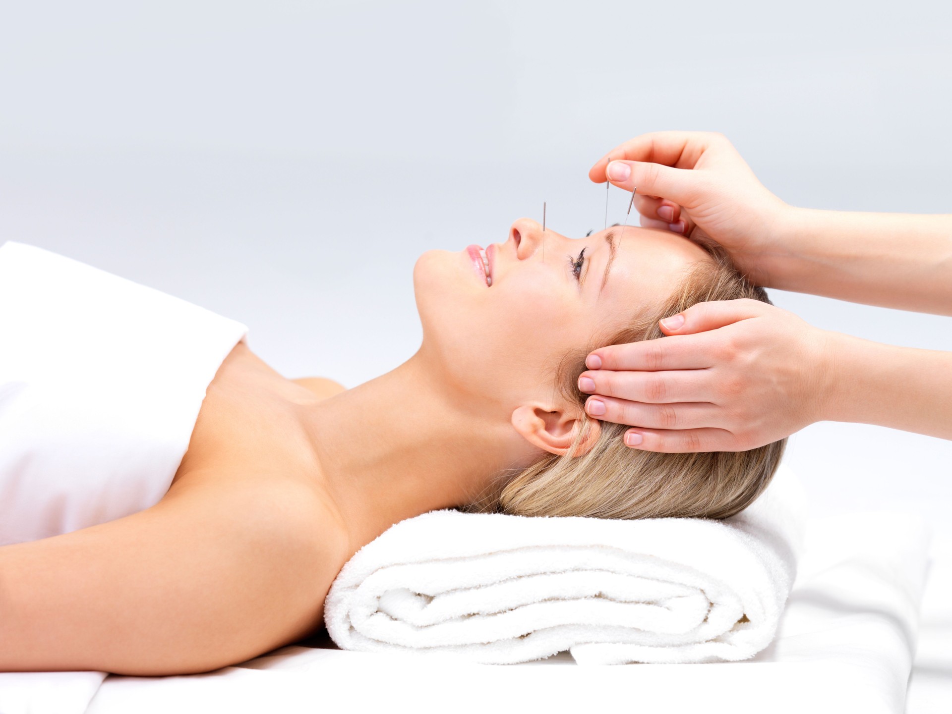 Acupuncture on a beautiful woman at the spa